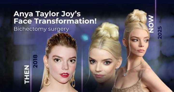 Exploring Anya Chalotra Plastic Surgery Rumors