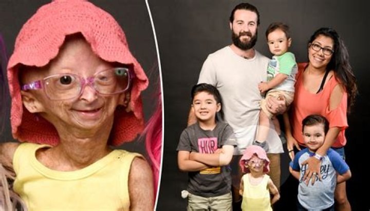 Is Adalia Rose Still Alive Or Dead? Wikipedia And Age As A Baby Photos