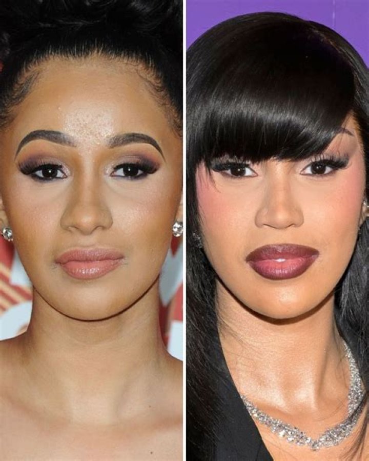 Plastic Surgery, Fame, And Beyond