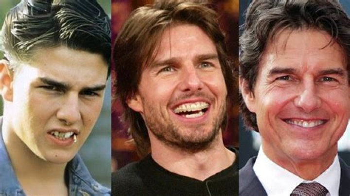 Tom Cruises Signature Smile Didn't Come Easy: He Had to Overcome Several Dental Flaws